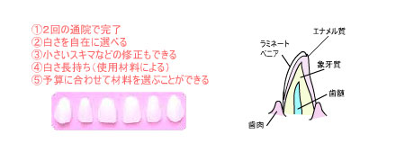 審美歯科での歯のホワイトニング辞典